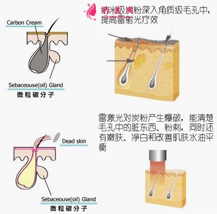 做黑脸娃娃哪里好