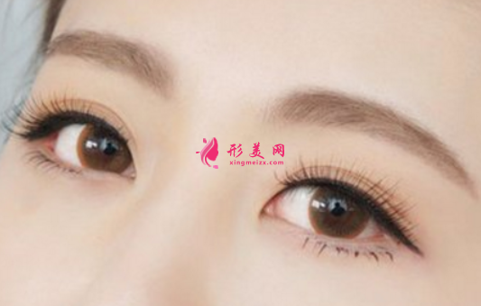 如何防止眼睛皮手术的风险？