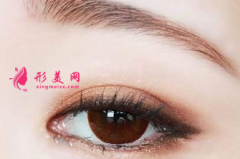 开眼角后什么时候可以化妆？