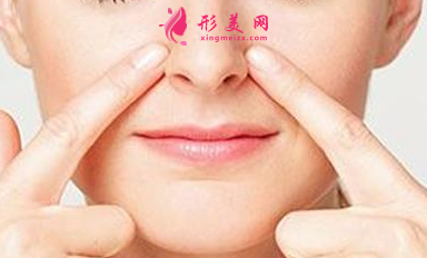 鼻翼缩小手术合适什么人群？