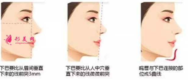 自体脂肪隆下巴效果如何缺点有什么呢