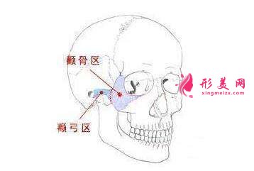 上海整形医院颧骨颧弓内推手术有哪些风险吗