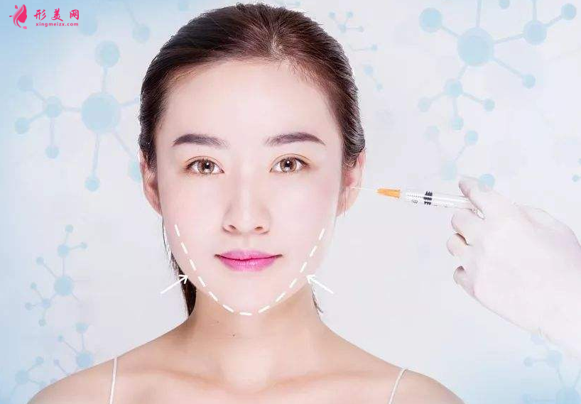 打瘦脸针要多少钱？注意事项大全~