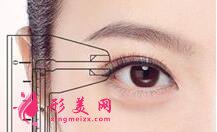 双眼皮手术过程痛苦吗