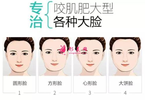 郑州整形医院打瘦脸针效果如何？瘦脸针价格~