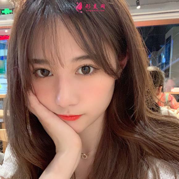 面部脂肪填充手术真实恢复过程，记录美好生活