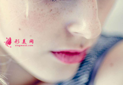激光祛雀斑影响正常上班吗