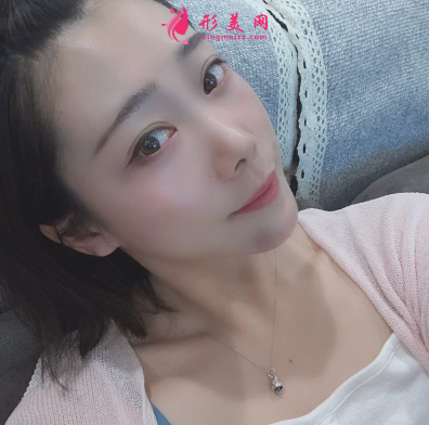 韩缘聚美做水氧活肤怎么样呢？案例30天术后效果真的好极了