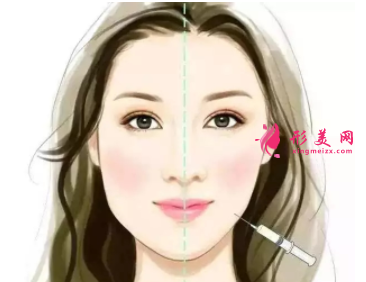 打瘦脸针需要注意的地方是什么？