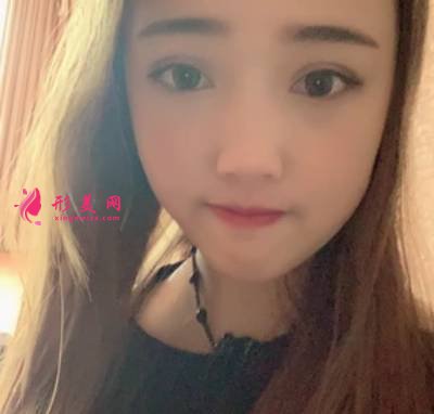 在北京301整形医院找雷永红医生做手术祛疤手术后