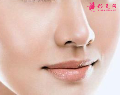 自体软骨隆鼻术后成效怎么样？