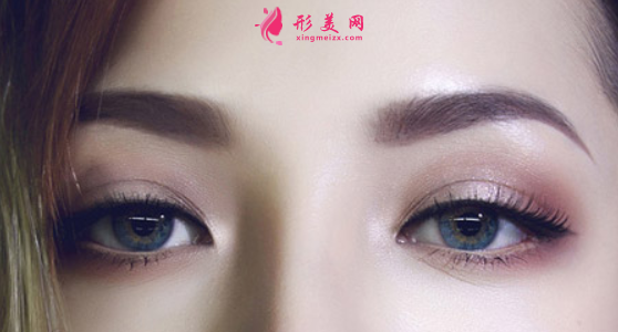 埋线双眼皮后脱线怎么办