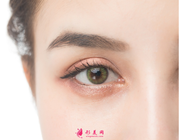 做眼睛皮的形状有多少种