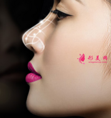 自体软骨隆鼻的价格是多少
