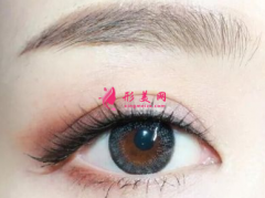 眼睛变大的手术方法？