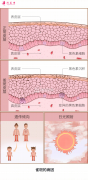 脸上的雀斑要怎么祛掉？