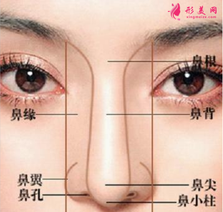 整鼻梁一般要多少钱