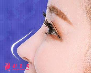 自体肋骨隆鼻维持多长时间？