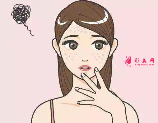 怎么样改变脸上的色斑