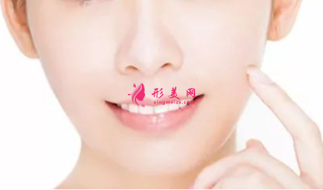 激光祛斑费用价格是多少
