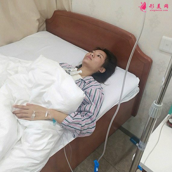 人要学会怜惜自己的整形术后图片