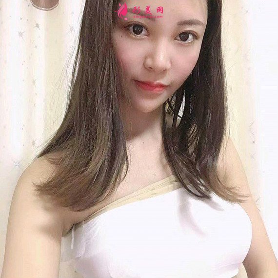 人要学会怜惜自己的整形术后图片
