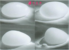 假体隆胸以后还能取出隆胸假体吗？