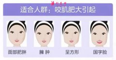 打瘦脸针多少天可以看到效果？