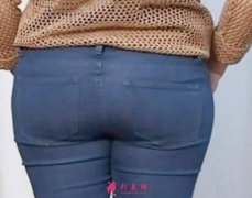 臀部吸脂恢复期是多久？