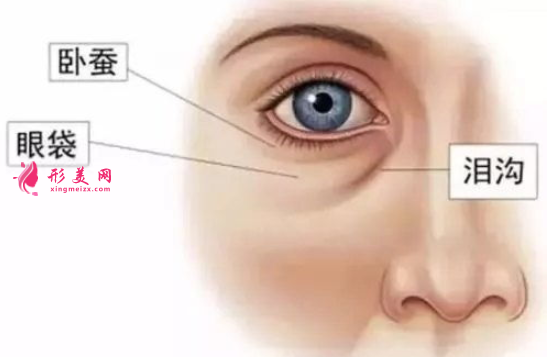 青年为何会有眼袋？