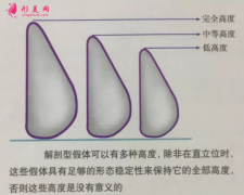 假体隆胸后吃什么比较好？