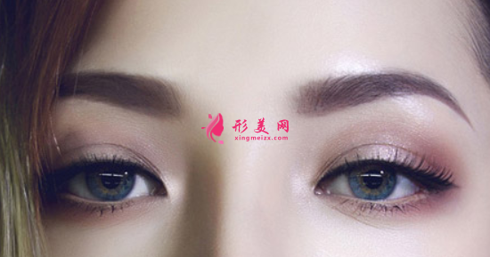 埋线眼睛皮如何迅速恢复？