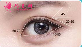 做开眼角手术后会回缩吗？