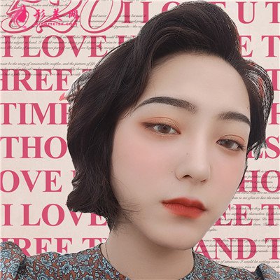 成都小姐姐切开双眼皮术后恢复情况分享