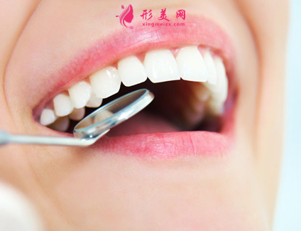 做烤瓷牙的价格是多少