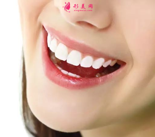 做烤瓷牙的价格是多少