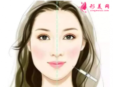 注射瘦脸针效果好不好？