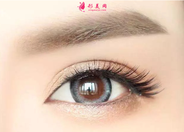 开眼角后多久可以戴隐形眼睛