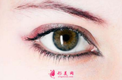 开眼角后多久可以戴隐形眼睛