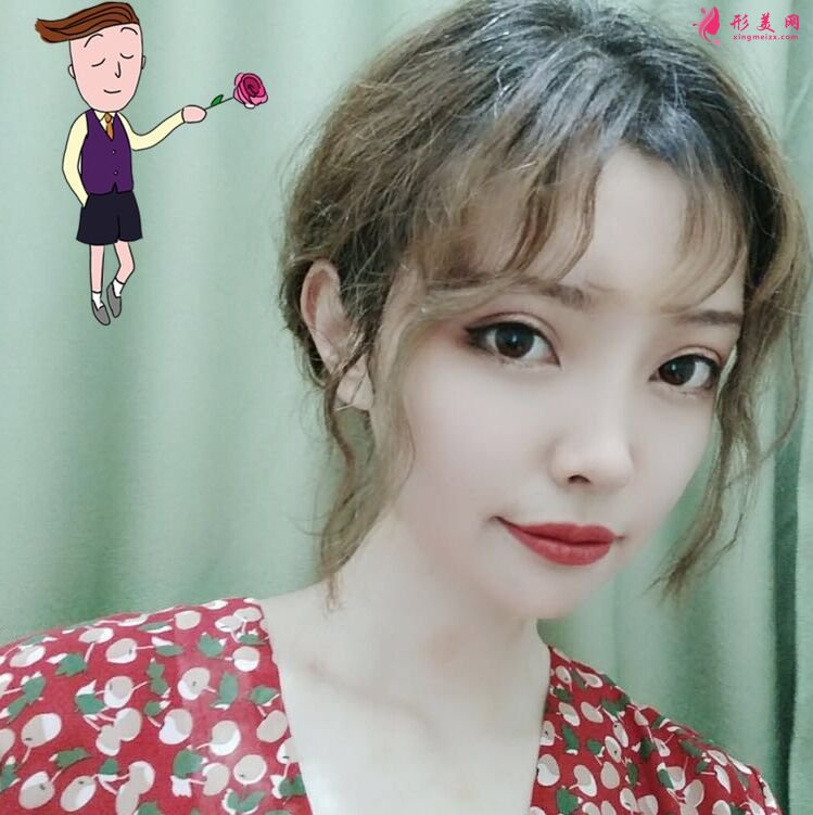 术后三十五条,自体脂肪