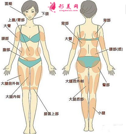 腰腹部吸脂应该注意的护理事情