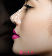 假体隆鼻效果好不好？