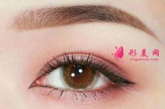 开眼角失败了可以修复吗？