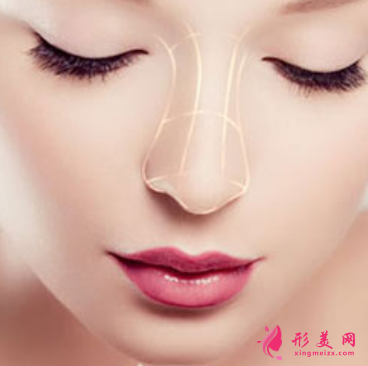 做软骨隆鼻可以保持多久