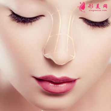 假体隆鼻后要如何护理