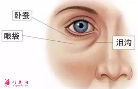 男性眼袋怎么祛除