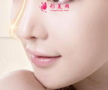 肋软骨隆鼻后会被吸收吗？