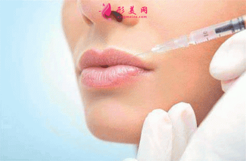 深圳福华整形医院：丰唇手术后的护理说明