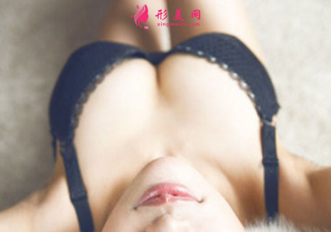 隆胸假体型号大小要怎么选