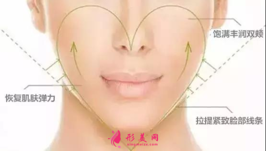 自体脂肪填充脸部可以维持多少年